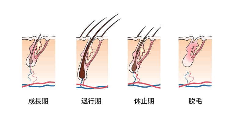 hair-loss-progress-03